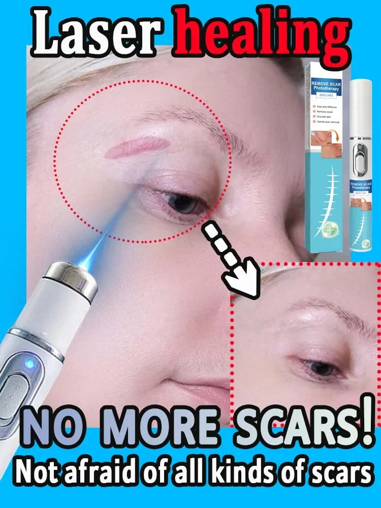 Laser Scar Hot 𝐒𝐜𝐚𝐫 𝐫𝐞𝐦𝐨𝐯𝐚𝐥 𝐬𝐜𝐚𝐫 𝐫𝐞𝐜𝐨𝐯𝐞𝐫𝐲 𝐫𝐚𝐩𝐢𝐝 𝐫𝐞𝐦𝐨𝐯𝐚𝐥 𝐨𝐟 𝐬𝐮𝐫𝐠𝐢𝐜𝐚𝐥 𝐬𝐜𝐚𝐫𝐬