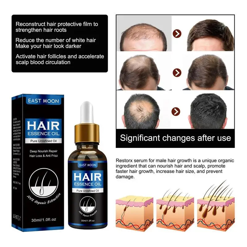 Hair Growth Oil Rapid Effective Repair Baldness Hair Follicles Repair Hereditary Hair Loss Postpartum Hair Loss Seborrheic Hair