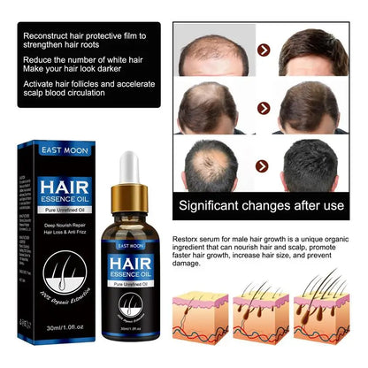 Hair Growth Oil Rapid Effective Repair Baldness Hair Follicles Repair Hereditary Hair Loss Postpartum Hair Loss Seborrheic Hair