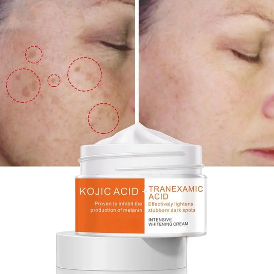 Anti Freckle Pearl Skin Brightening Cream Remove Face Spot Brighten Skin Contain Herbal Serum Skin Care Face Essence