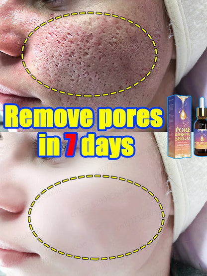 pores remover pore shrinking serum shrink Tightening Minimizing