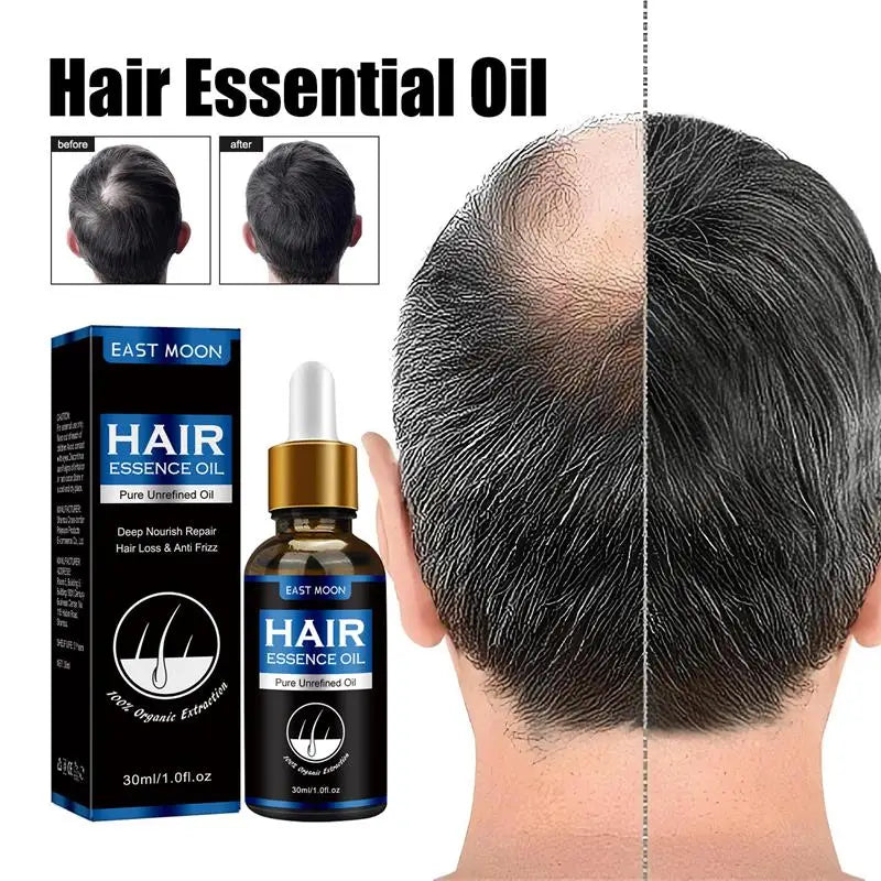 Hair Growth Oil Rapid Effective Repair Baldness Hair Follicles Repair Hereditary Hair Loss Postpartum Hair Loss Seborrheic Hair