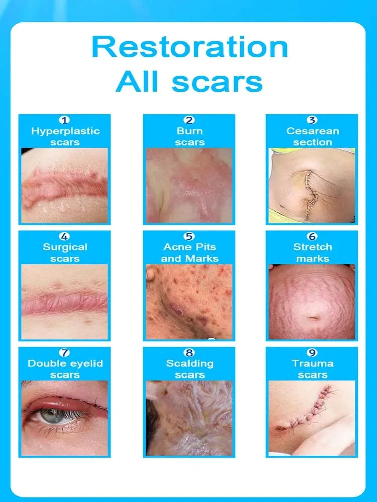 Laser Scar Hot 𝐒𝐜𝐚𝐫 𝐫𝐞𝐦𝐨𝐯𝐚𝐥 𝐬𝐜𝐚𝐫 𝐫𝐞𝐜𝐨𝐯𝐞𝐫𝐲 𝐫𝐚𝐩𝐢𝐝 𝐫𝐞𝐦𝐨𝐯𝐚𝐥 𝐨𝐟 𝐬𝐮𝐫𝐠𝐢𝐜𝐚𝐥 𝐬𝐜𝐚𝐫𝐬