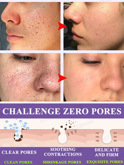 pores remover pore shrinking serum shrink Tightening Minimizing