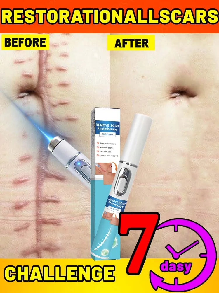 Laser Scar Hot 𝐒𝐜𝐚𝐫 𝐫𝐞𝐦𝐨𝐯𝐚𝐥 𝐬𝐜𝐚𝐫 𝐫𝐞𝐜𝐨𝐯𝐞𝐫𝐲 𝐫𝐚𝐩𝐢𝐝 𝐫𝐞𝐦𝐨𝐯𝐚𝐥 𝐨𝐟 𝐬𝐮𝐫𝐠𝐢𝐜𝐚𝐥 𝐬𝐜𝐚𝐫𝐬