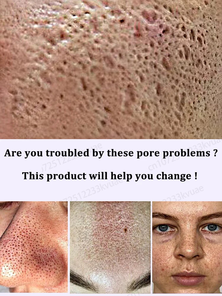 pores remover pore shrinking serum shrink Tightening Minimizing