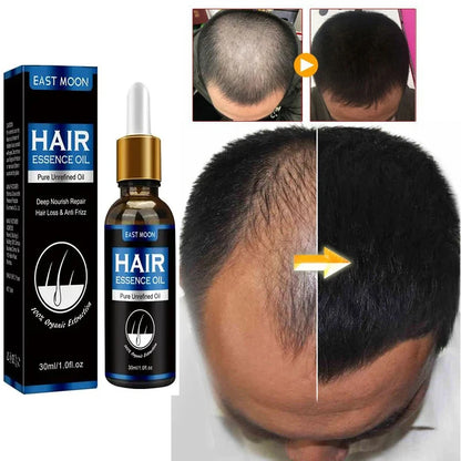 Hair Growth Oil Rapid Effective Repair Baldness Hair Follicles Repair Hereditary Hair Loss Postpartum Hair Loss Seborrheic Hair